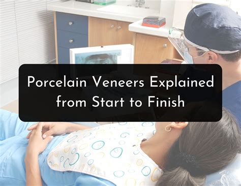 The Porcelain Veneers Procedure Described Step-by-Step