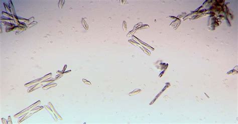 Veterinary Clinical Pathology: Urinalysis: Unstained Canine Urine ...