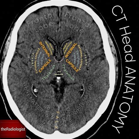 The Radiologist on Instagram: “Check out this axial slice of a non ...