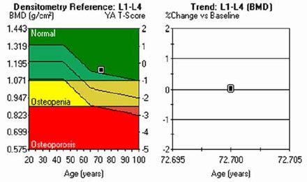 Bone Density Testing | Mid Rogue Imaging Center