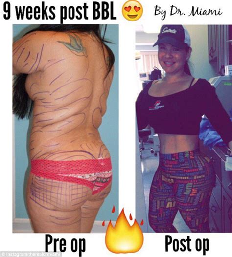 Dr miami finds fame after posting graphic before and after plastic ...