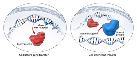 Genetic Therapies | NHLBI, NIH