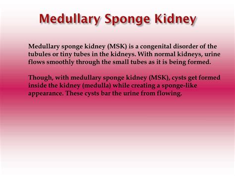 PPT - Medullary Sponge Kidney: Causes, Symptoms, Daignosis, Prevention ...