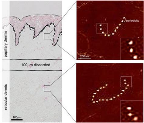 Heterogeneity of fibrillin‐rich microfibrils extracted from human skin ...