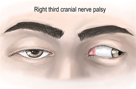 Cranial Nerve III Oculomotor Nerve [Part 1] Origin,, 44% OFF