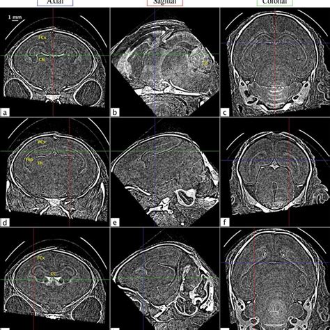 Propagation-based X-ray phase contrast imaging (adapted from Kitchen et ...