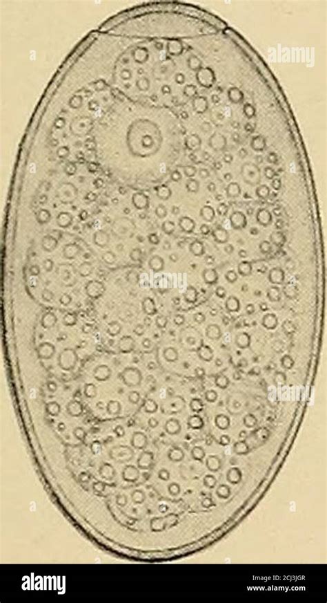 . Physical diagnosis . Fasciola hepatica Stock Photo - Alamy