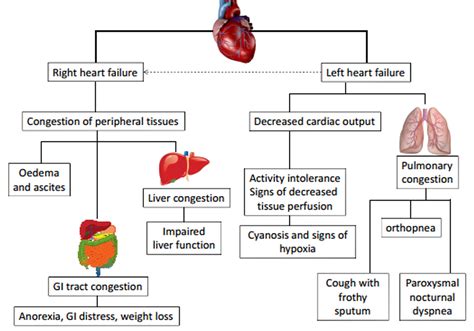 Right And Left Sided Heart Failure | Marilyn Reports