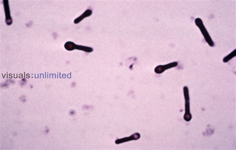 Clostridium tetani Bacteria. LM | Visuals Unlimited