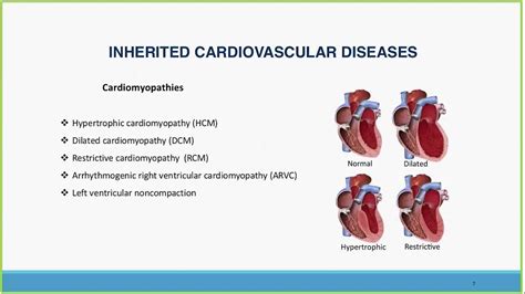 Genetic Testing For Heart Disease - Quotes Marco