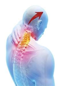 Cervicogenic Headache Exercises - Treat That Killer Headache With These ...