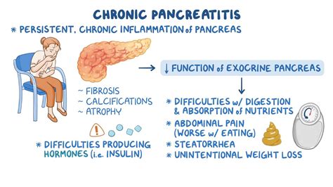 Chronic pancreatitis: Clinical sciences - Osmosis Video Library