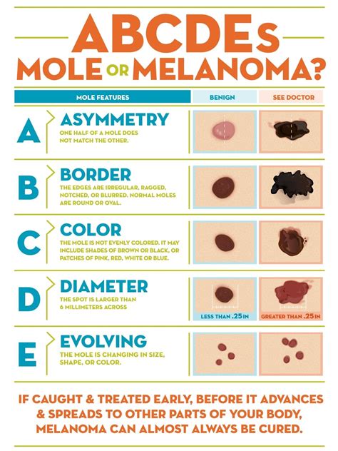 Melanoma Skin Moles