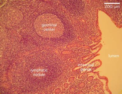 Appendix Histology - Appendix (labels) - histology slide