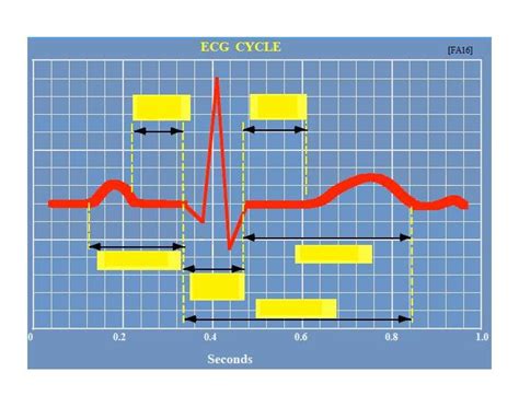 ECG cycle Quiz