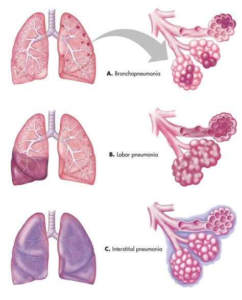 A review of all sections of clinical laboratory science, helpful study ...