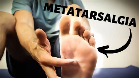 BEST Metatarsalgia Exercises, Massage & Stretches [HOME Treatment]