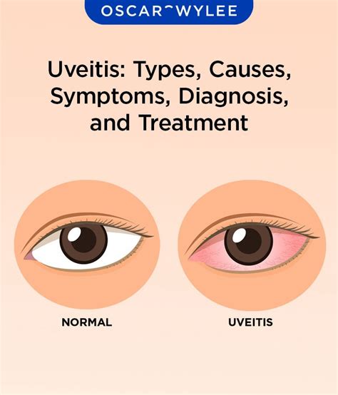 Uveitis In Dogs Symptoms Causes Diagnosis Treatment