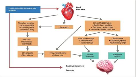 Guide To Atrial Fibrillation: Causes, symptoms and treatments