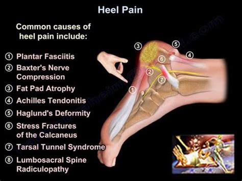 Sickness grass None human heel pain barricade chop muscle