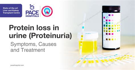 Protein loss in urine (Proteinuria) - Symptoms, Causes and Treatment