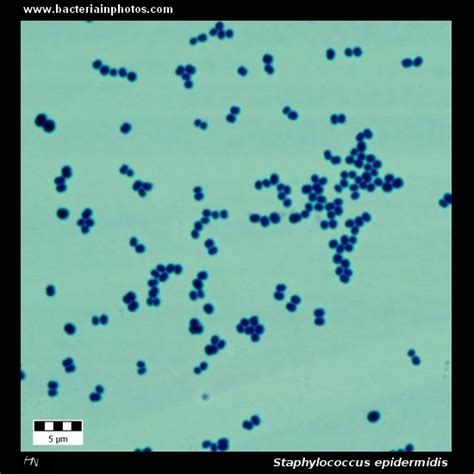 Staphylococcus epidermidis under microscope: microscopy of Gram ...