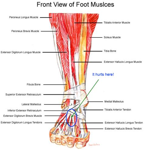 Let's Run Homey!: Pain in the top of the foot.