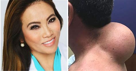 Dr. Pimple Popper Is Getting Her Own TV Show, And The Trailer Already ...