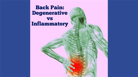 Back Pain- Inflammatory versus Degenerative - Chicago Arthritis and ...