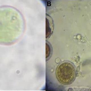 Schematic of Haematococcus pluvialis cultivation set-up. | Download ...