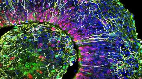 Scientists Create Miniature Brains From Stem Cells - LifeNews.com