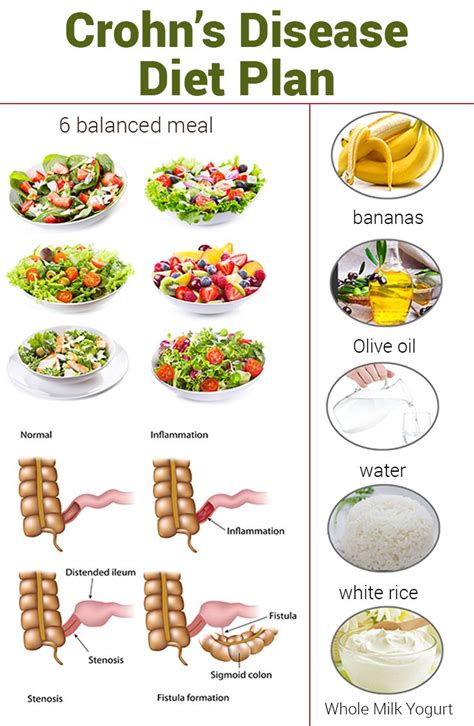 Crohn’s Disease Diet Plan – What Is It And How Does It Work? | What is ...