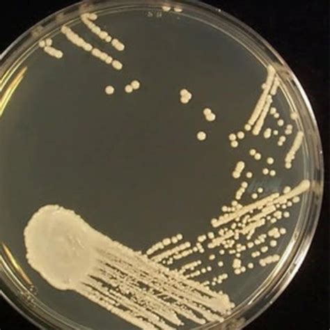 Sabouraud Dextrose Agar Plate - MLRS