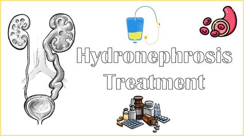 Hydronephrosis Treatment - Medical & Surgical Management Of ...