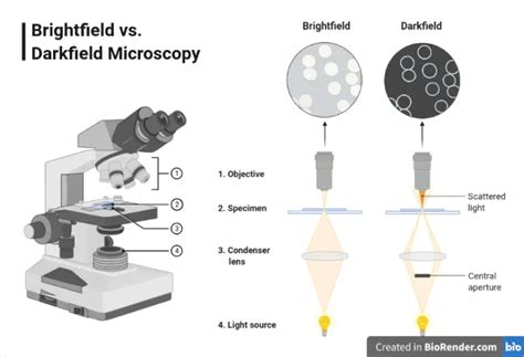 Dark-field Microscopy: Principle and Uses – Microbe Online