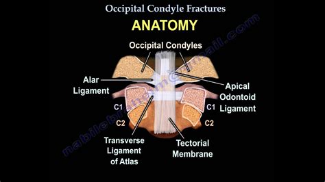 Occipital Condyle Fractures - Everything You Need To Know - Dr. Nabil ...