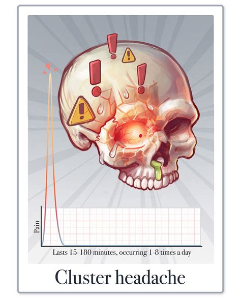 Causes of headache — artibiotics | Headache, Cluster headaches, Medical ...