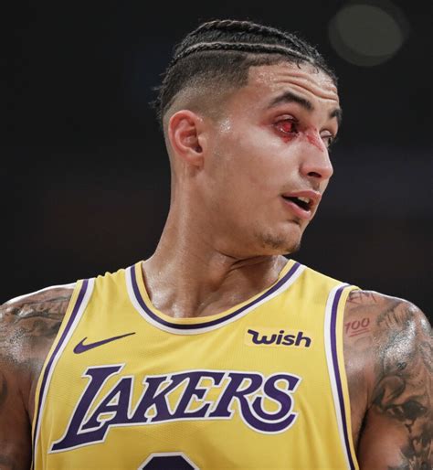 Lakers forward Kyle Kuzma to wear goggles to protect right eye - Los ...