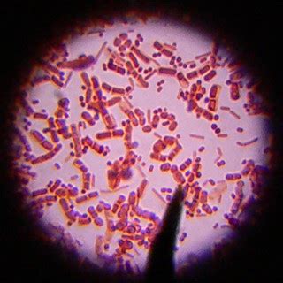 Bacteria | Bacilli and Cocci, colored with the Gram staining… | Flickr