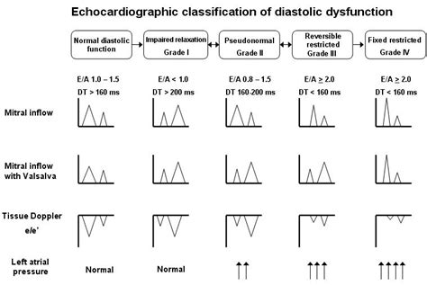 Diastolic Dysfunction - Physiology and echocardiography | LearnTheHeart.com