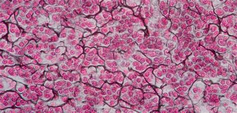 Reticular connective tissue (image from the web) | Fiber, Tissue ...