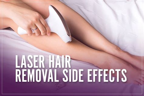 Laser hair removal side effects