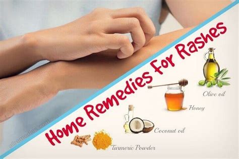 How to Get Rid of Skin Rash Fast (Home Remedies) - Hickey Solution