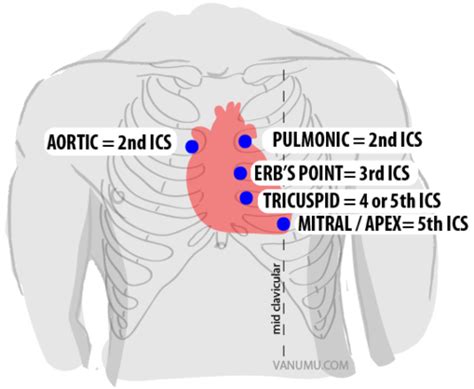 Auscultation of heart....placement of stethoscope Nursing Assessment ...