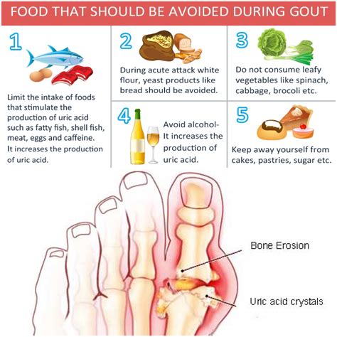 What About Gout? – Holistic Health by Jessie Lam