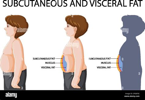 Subcutaneous and visceral fat diagram illustration Stock Vector Image ...