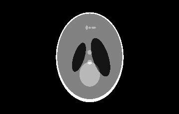 Phase-contrast X-ray Imaging (PCI) | Technical Detail | TomoShop - New ...