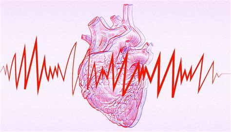 Do You Know the Warning Signs of A-Fib? - TrendRadars