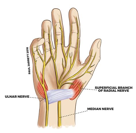 Branches Of Median Nerve Below Wrist Median Nerve Nerve Nerve Anatomy ...