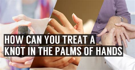 Knots and Lump in Palm of Hands | Symptoms & Home Treatment